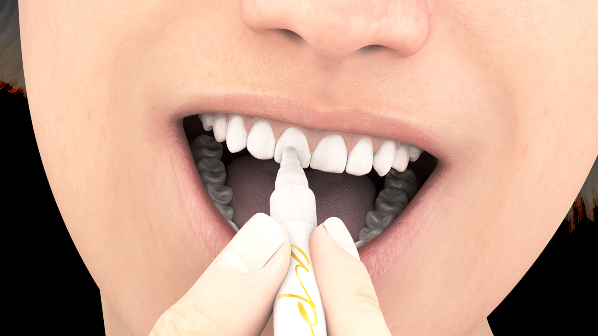 Whitening